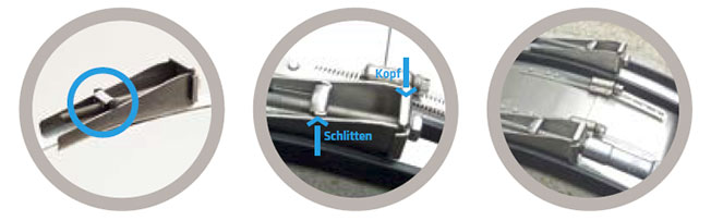 patentiertes spann verschluss system